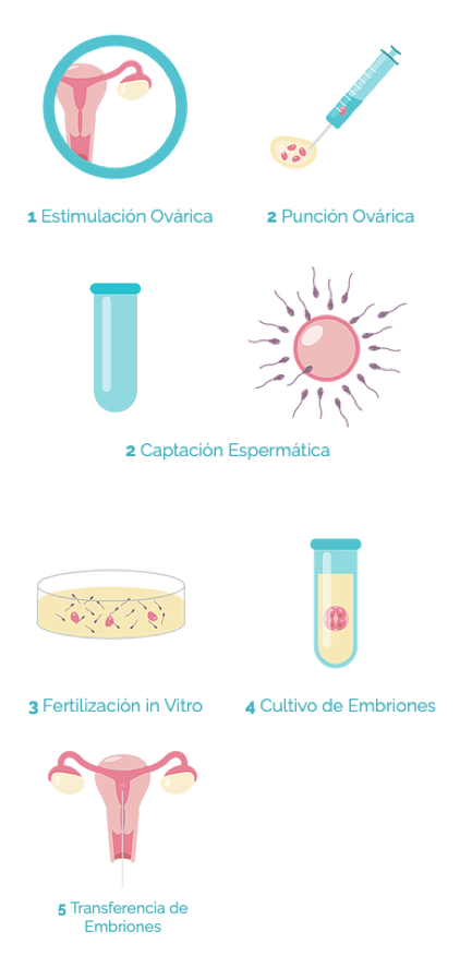 Inseminación In vitro
